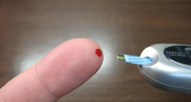 best time to check blood sugar type 2 diabetes